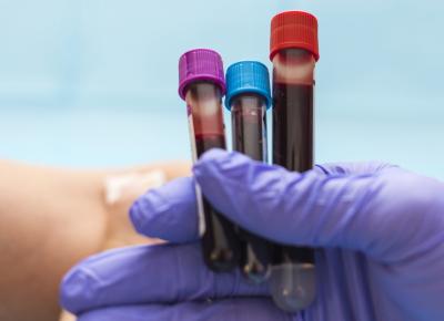 Expert seeks public awareness on blood safety, lab tech accuracy